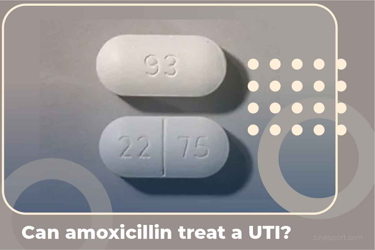 Yes, amoxicillin can treat UTI (Urinary Tract Infection). However, we must pay attention to several things before doing treatment.